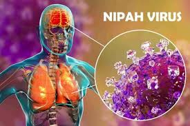 Ministério da Saúde diz que vírus Nipah não representa ameaça ao Brasil